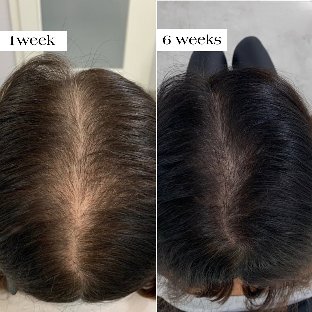 Before and After