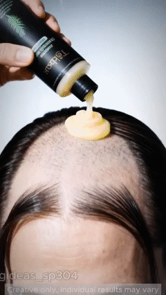 Hair Loss Danger